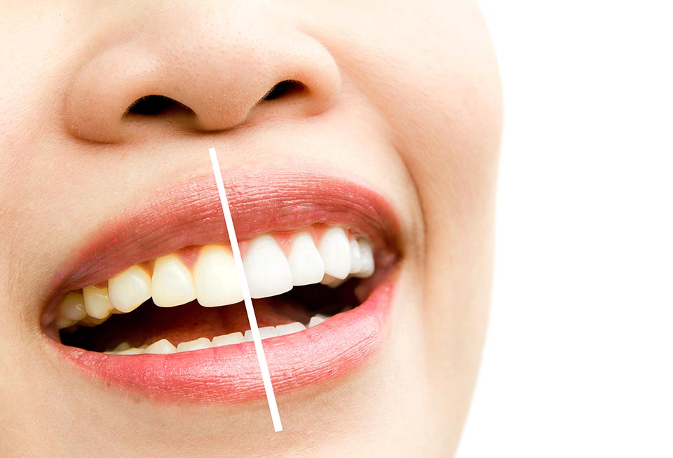 Dentística
